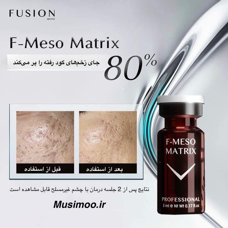 عکس محصول مزوتراپی فیوژن اورجینال جهت درمان جای زخم و ترک پوستی