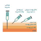 کوکتل مزوتراپی تقویت مو اف هیر فیوژن F-HAIR 10 cc اصل دولیبل تاریخ ۲۰۲۸